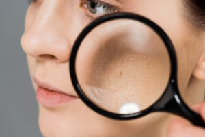 cropped view of young woman with magnifier near problem skin isolated on grey